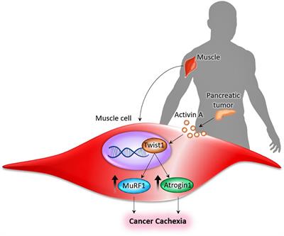 Regulatory Role of the Transcription Factor Twist1 in Cancer-Associated Muscle Cachexia